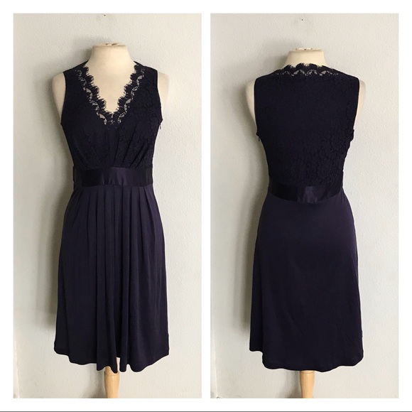 Banana Republic Dresses & Skirts - Banana Republic lace dress